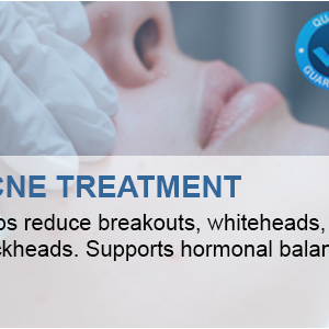 Acne Treatment